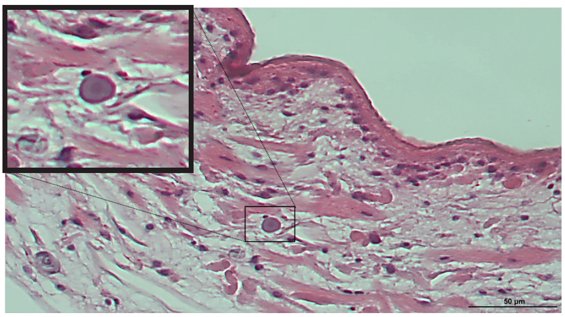 PHD-25105f1.jpg