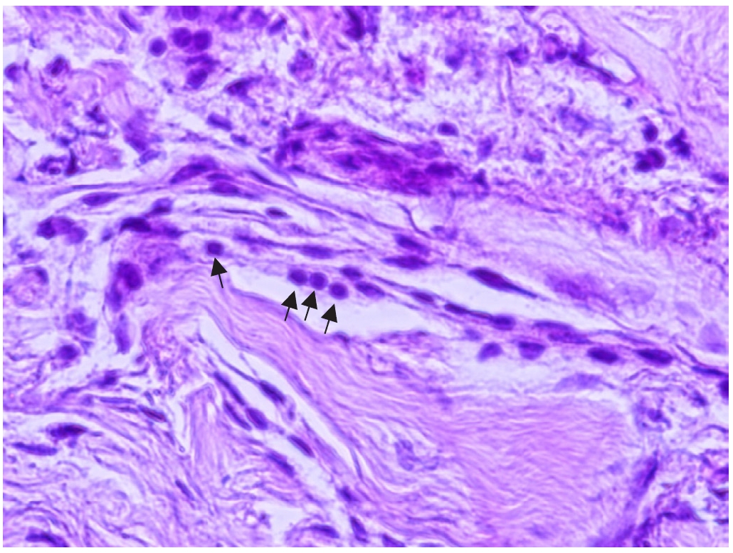 PHD-26004f5.jpg