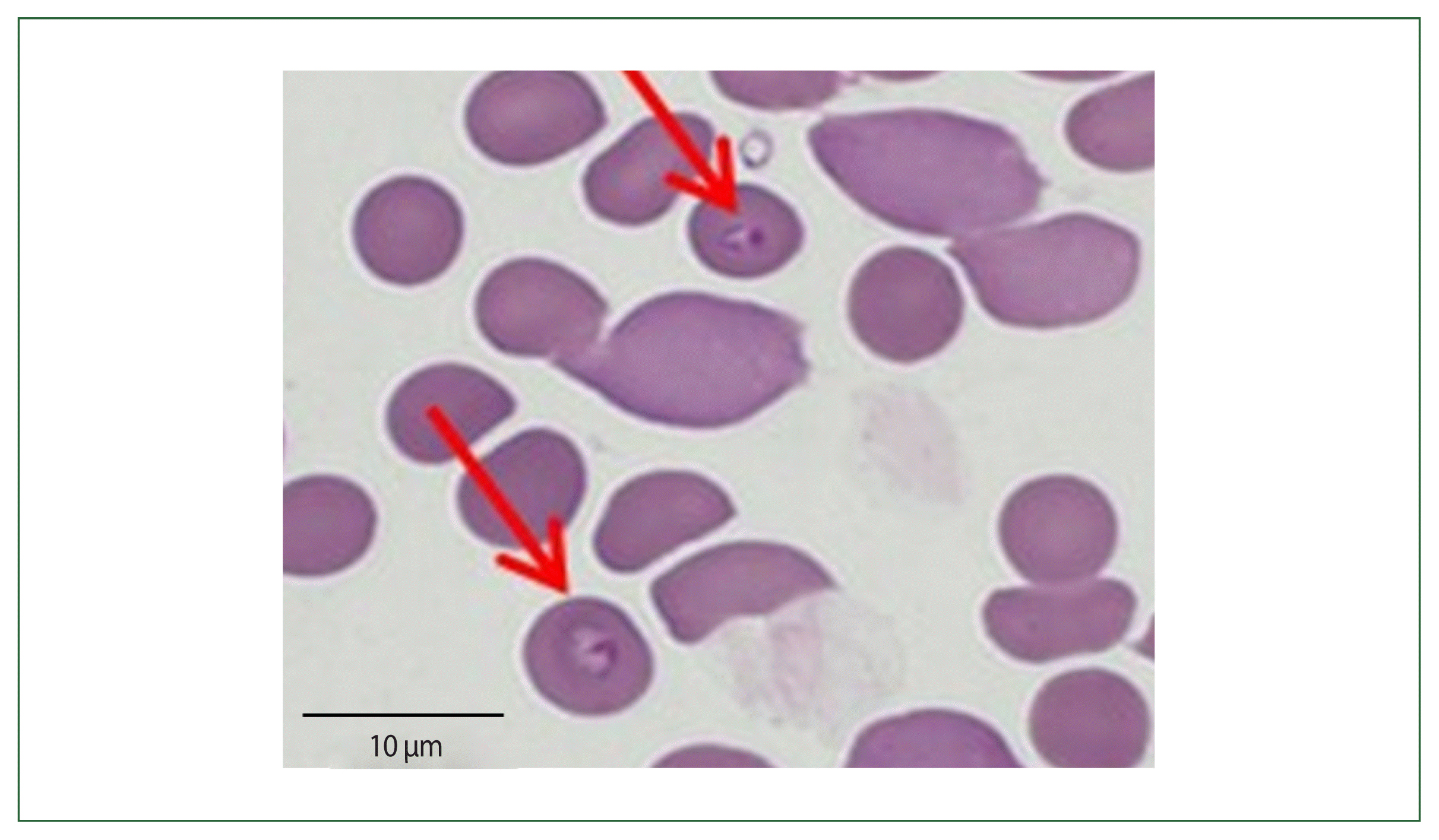 phd-22168f2.gif