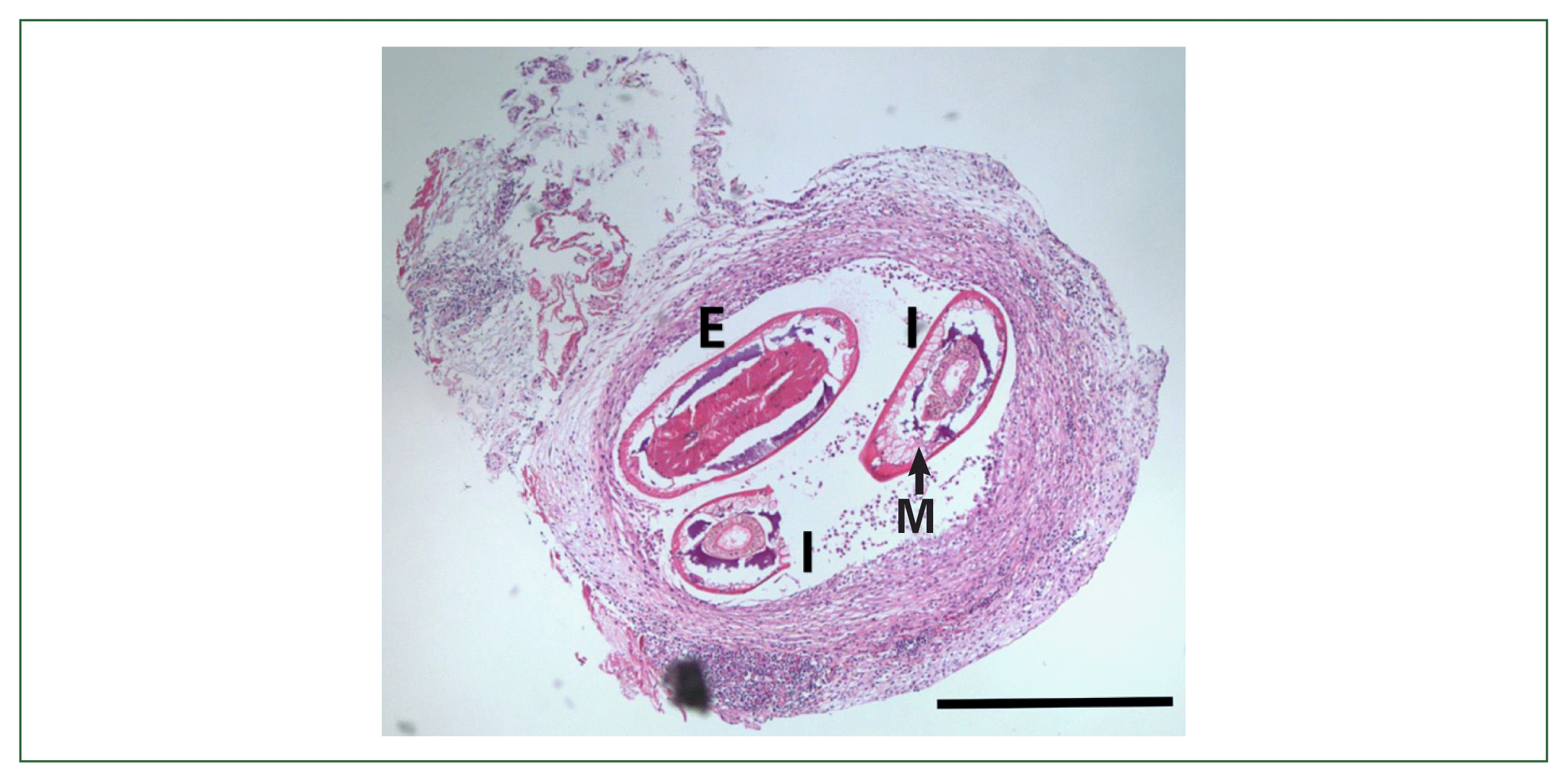 phd-23065f2.gif