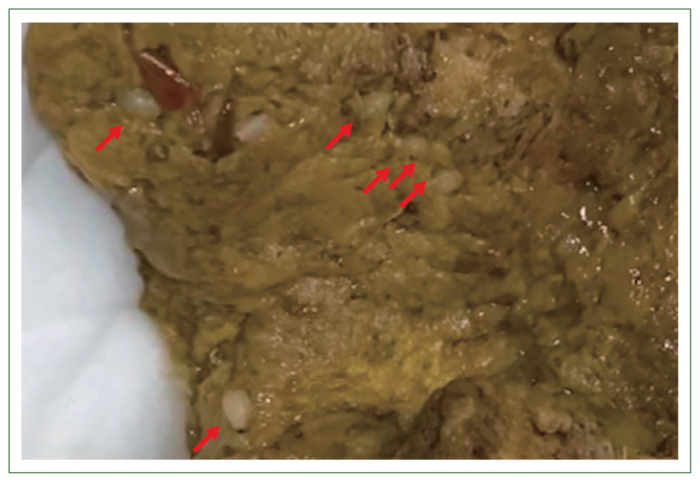 phd-23118f1.gif